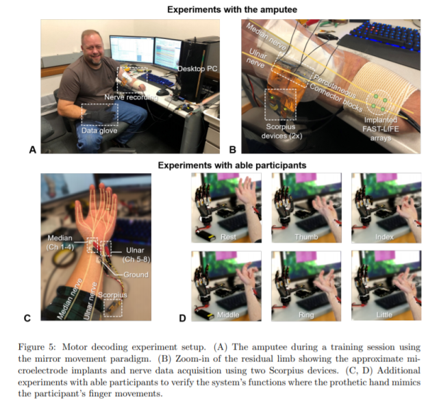 开发板能这么用？美国学者用Jetson Nano支持假肢，控制每一根手指
