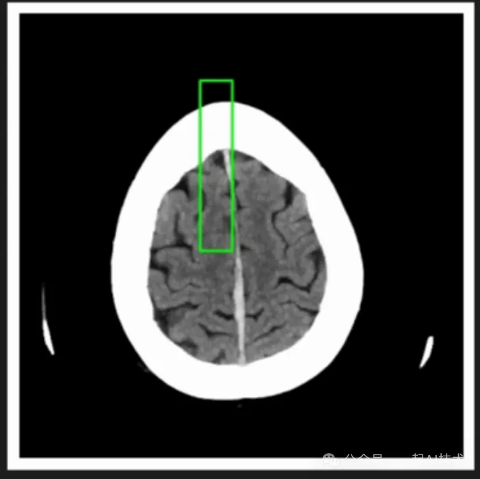 我训练了一个医疗多模态大模型帮家里老人看病-AI.x社区